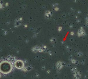 Spores of Nosema maddoxi, a microsporidian, infecting an adult BMSB. Spores are the small, cylindrical, capsule-shaped objects, one of which is indicated by arrow. Photograph taken using a microscope with phase-contrast at 40x. (Photo: Emily Ogburn)